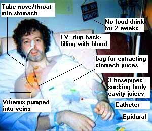 sickgaz1.jpg