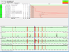 pingplotter8.png