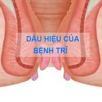 benhhoctri